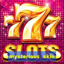 mysterious skin filme completo dublado